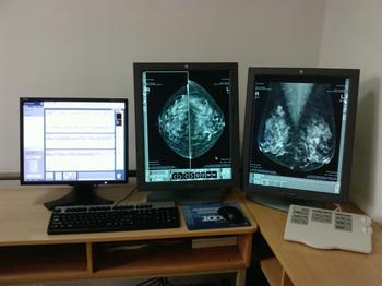 富士胶片推出巡诊车用数字化乳腺X线摄影系统