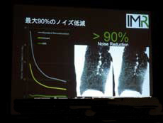 飛利浦日本上市面向X光CT裝置的圖像重建技術“IMR”