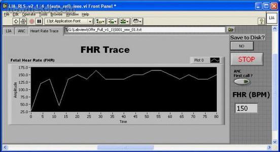 使用LabVIEW和NI硬件精確安全地測量胎兒心率