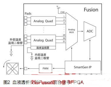 利用混合信號FPGA推動臨床醫(yī)療應用設備的發(fā)展